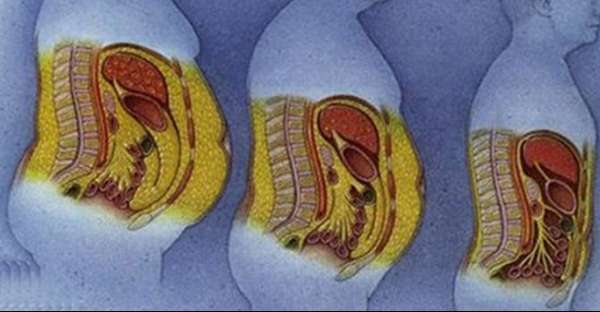 Scientific Study Finds Eating Coconut Oil Daily Leads to Weight Loss